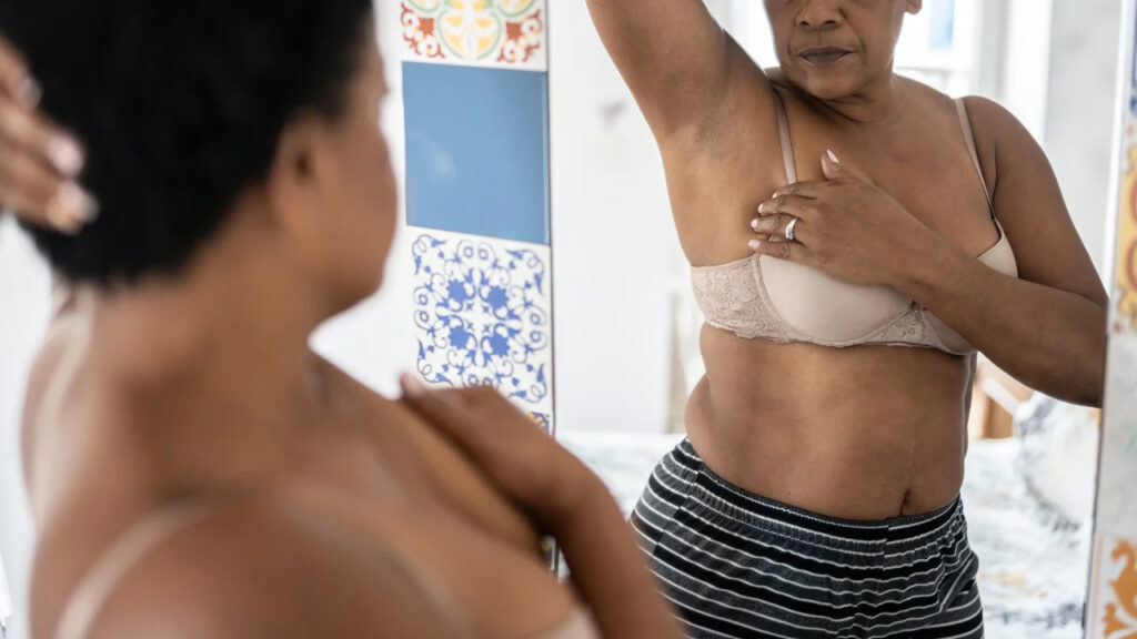 A lump isn’t the only sign of breast cancer. Here are 5 other clues